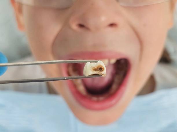 Best Walk-In Emergency Dentist in Wrightwood, CA