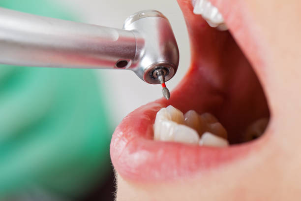 Best Emergency Broken Tooth Repair in Wrightwood, CA